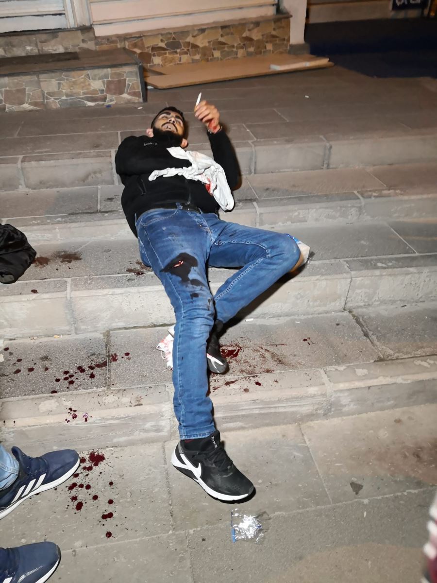 AKSARAYDA 2 GENCİN TARTIŞMASI KAVGAYLA BİTTİ.1 KİŞİ AĞIR YARALANDI.!